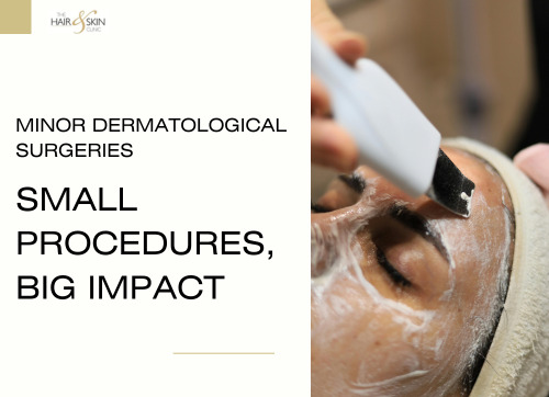 Minor Dermatological Surgeries – Small Procedures, Big Impact