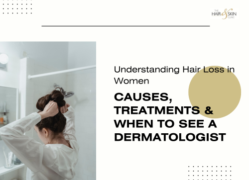 women hairloss